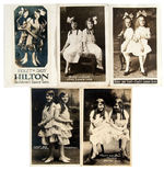 “VIOLET AND DAISY HILTON” SIAMESE TWINS REAL PHOTO POSTCARDS.